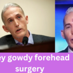 trey gowdy forehead surgery