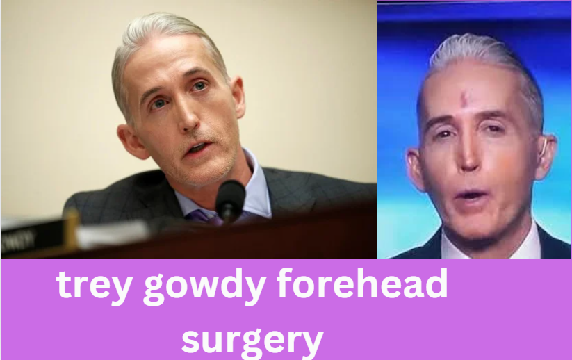 trey gowdy forehead surgery